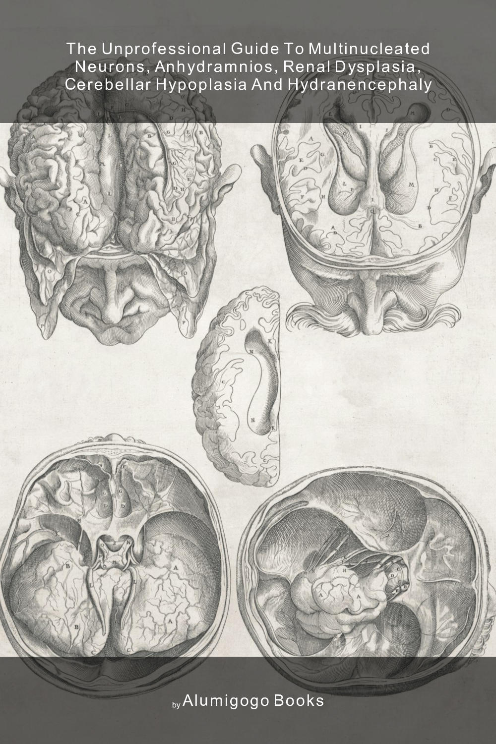 Cover of The Unprofessional Guide to multinucleated neurons, anhydramnios, renal dysplasia, cerebellar hypoplasia and hydranencephaly