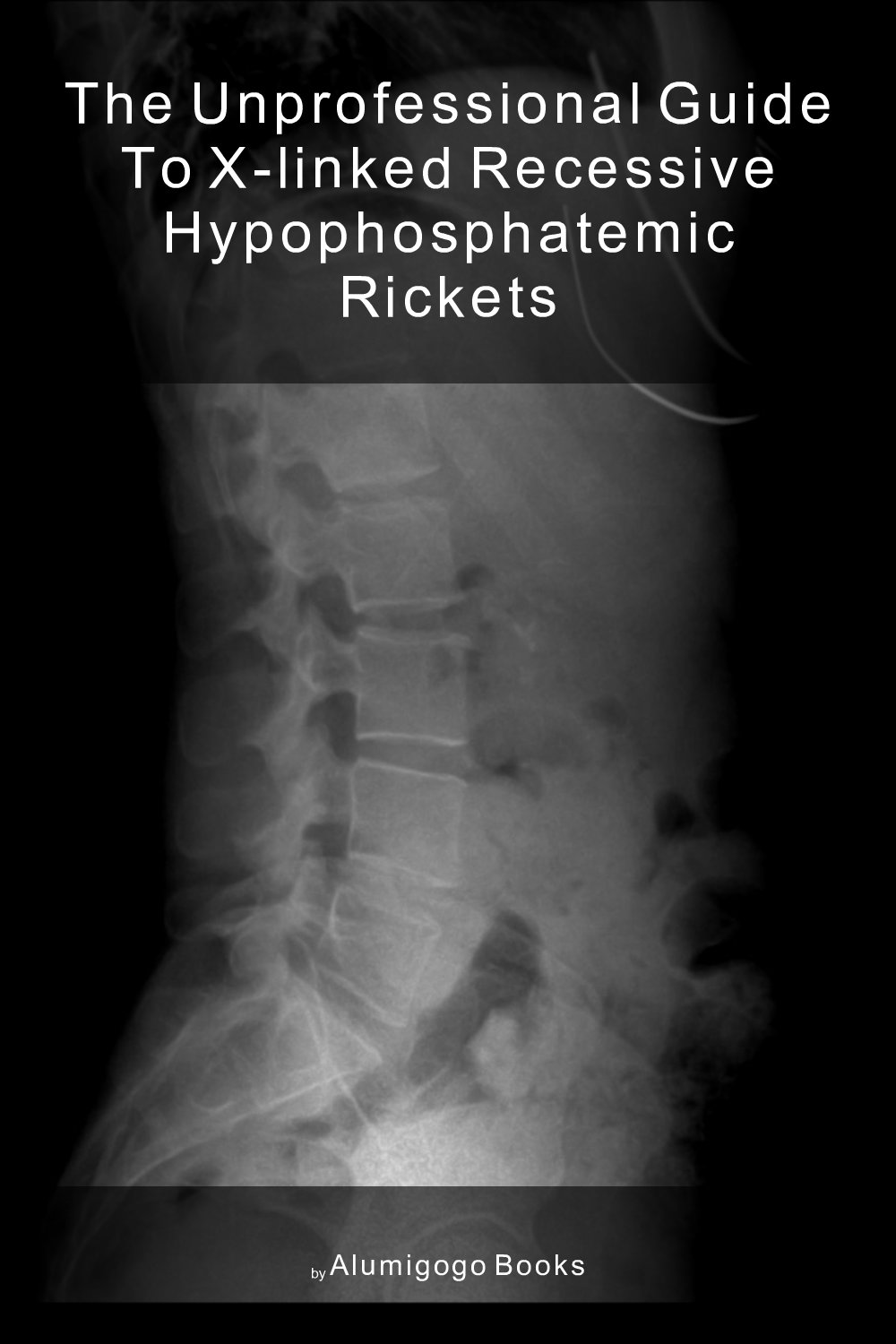 Cover of The Unprofessional Guide to X-linked recessive hypophosphatemic rickets
