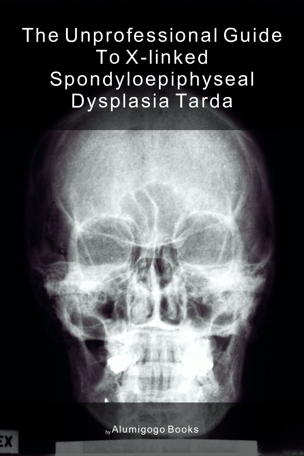 Cover of The Unprofessional Guide to X-linked spondyloepiphyseal dysplasia tarda