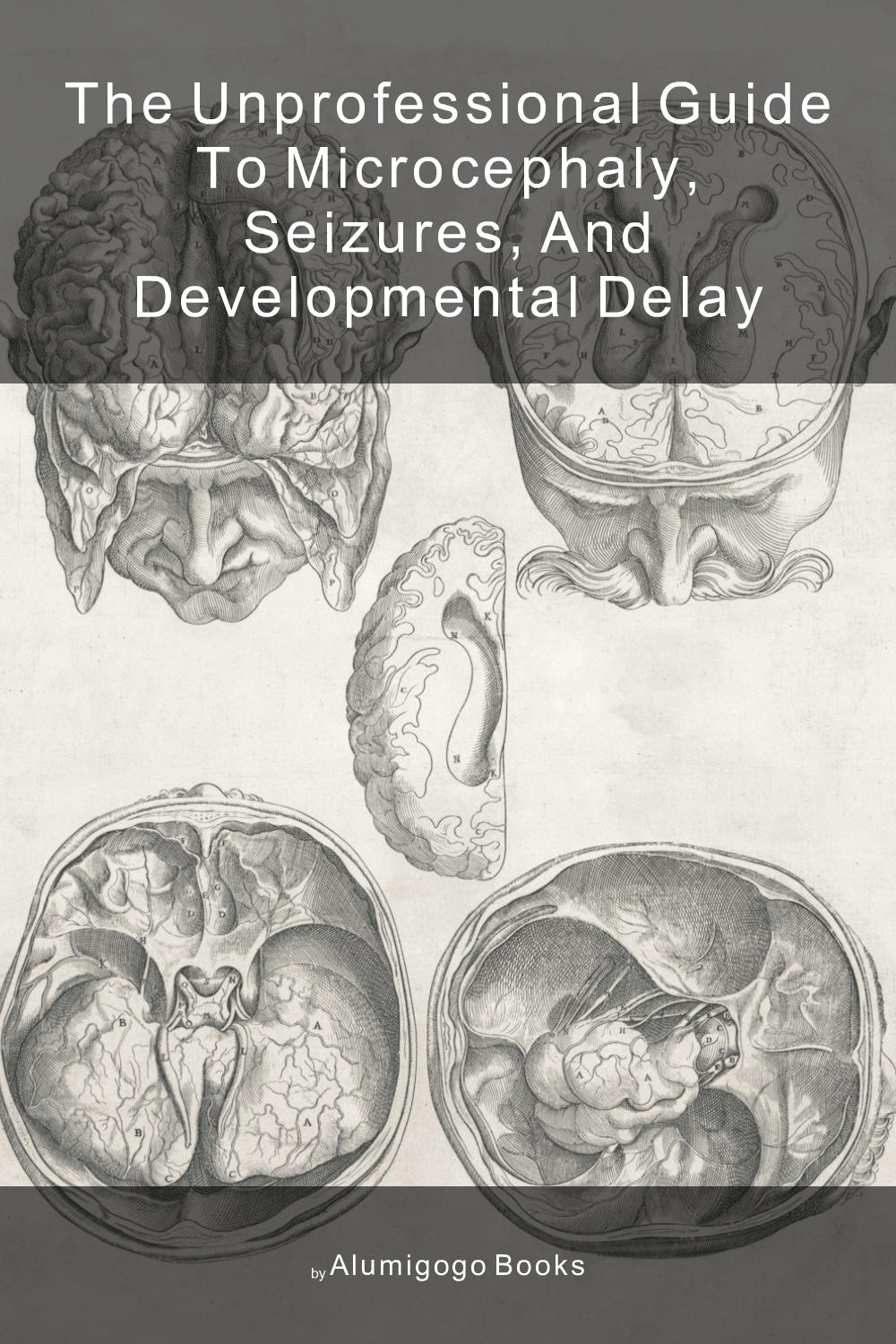 Cover of The Unprofessional Guide to microcephaly, seizures, and developmental delay