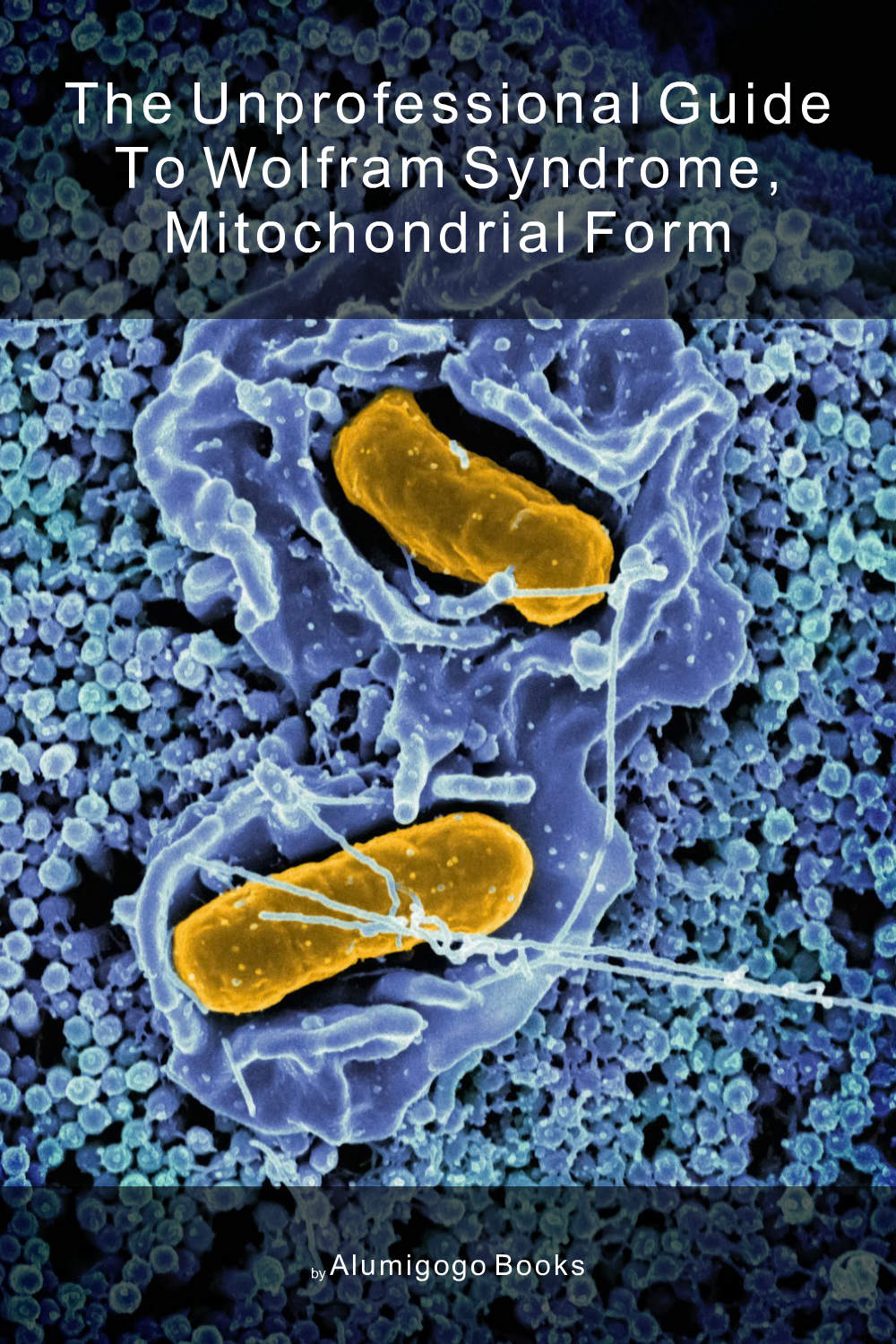 Cover of The Unprofessional Guide to Wolfram syndrome, mitochondrial form