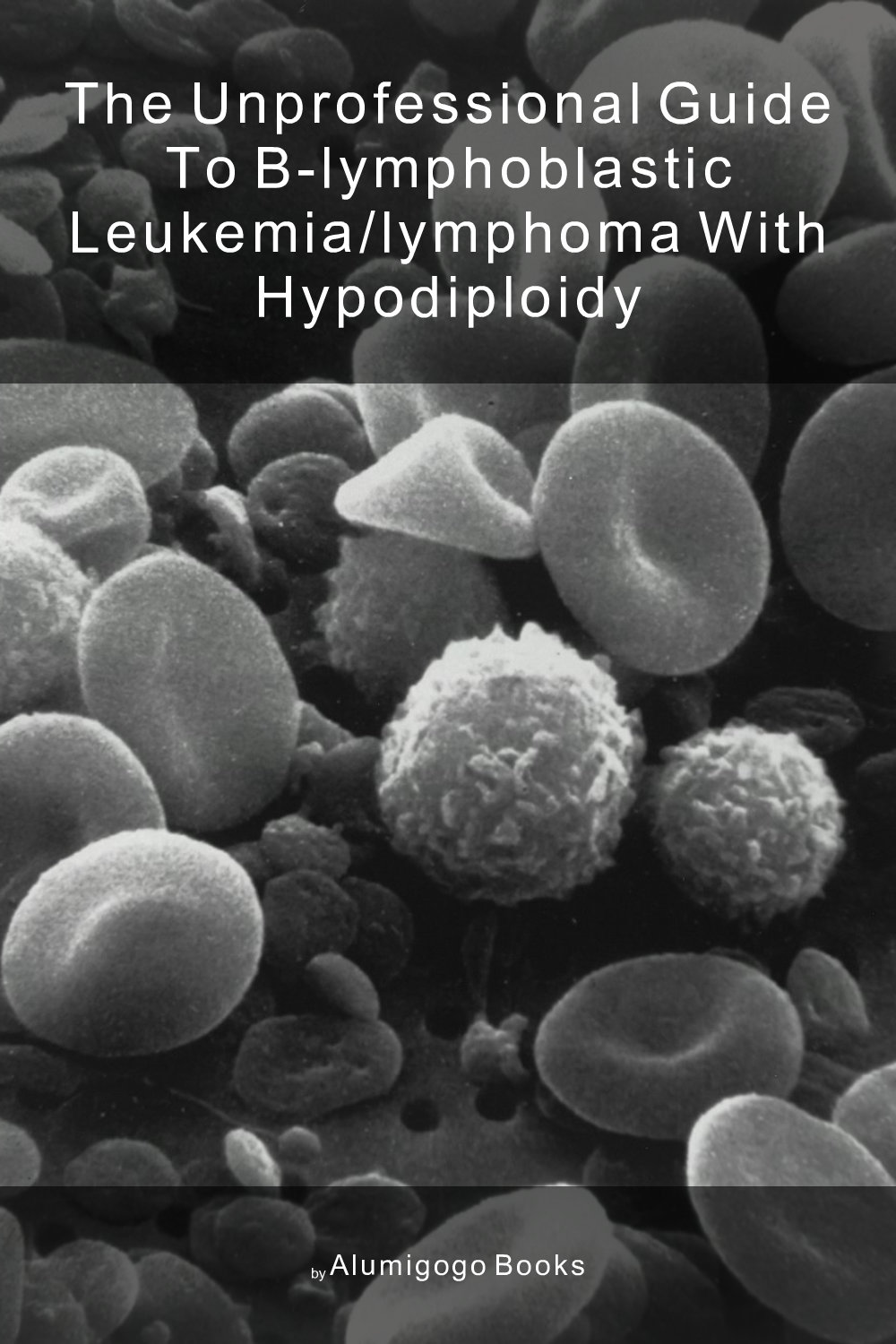 Cover of The Unprofessional Guide to B-lymphoblastic leukemia/lymphoma with hypodiploidy