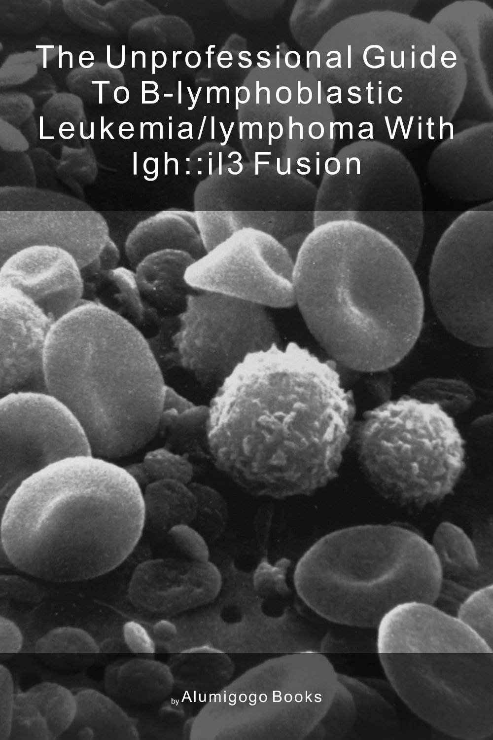 Cover of The Unprofessional Guide to B-lymphoblastic leukemia/lymphoma with IGH::IL3 fusion