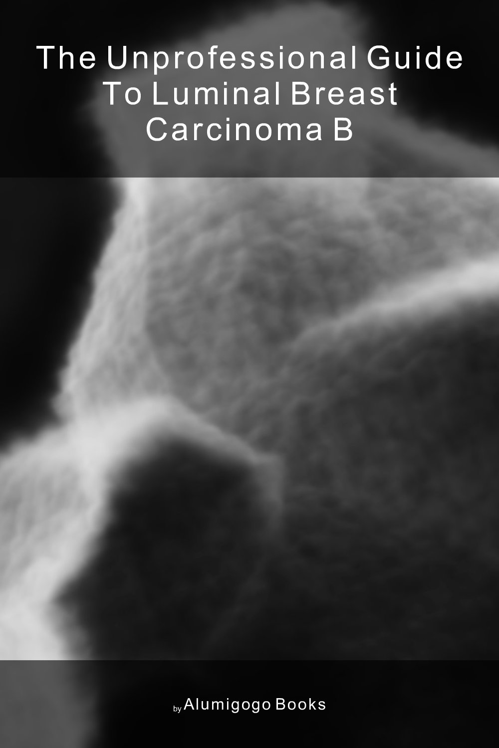 Cover of The Unprofessional Guide to luminal breast carcinoma B