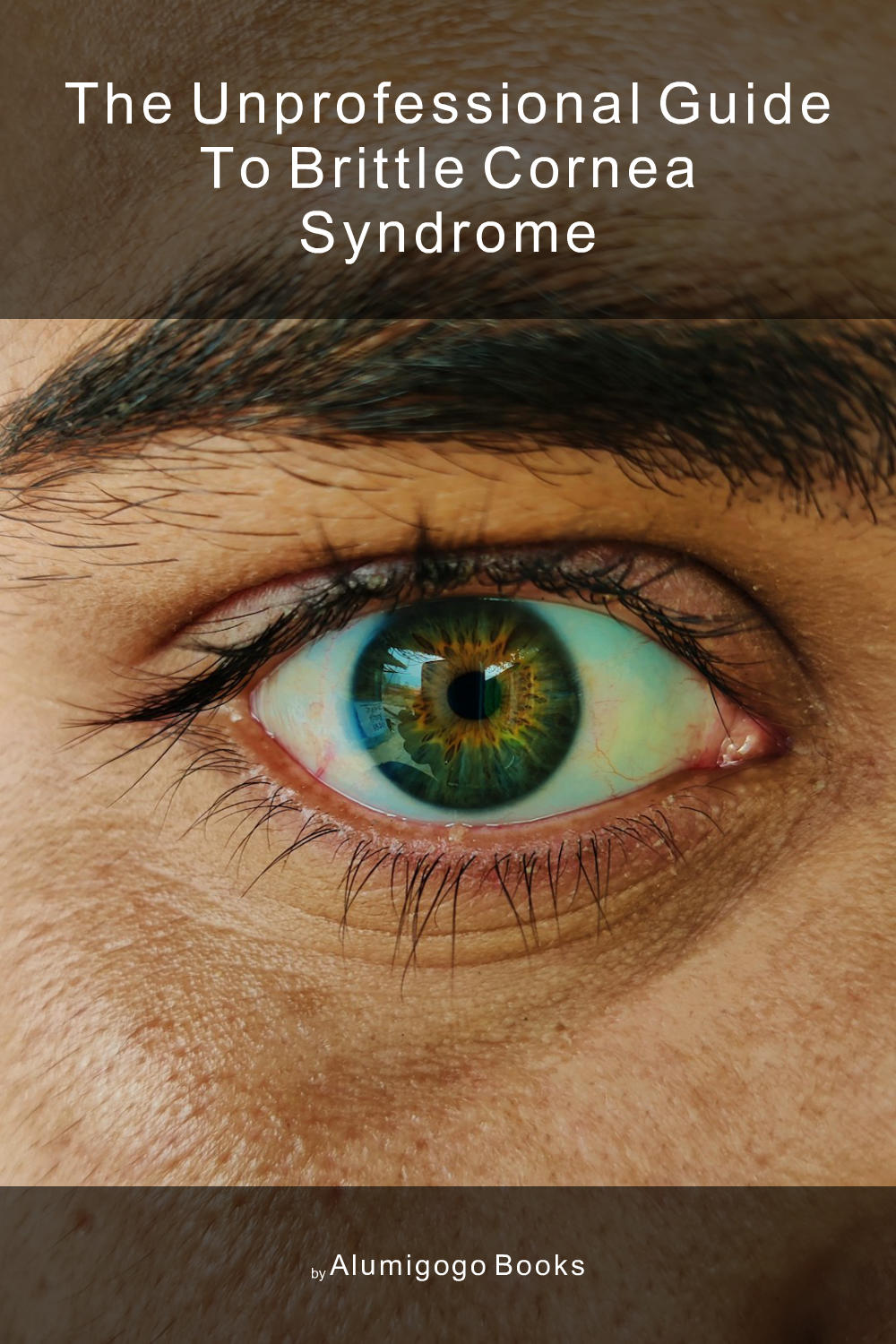 Cover of The Unprofessional Guide to brittle cornea syndrome