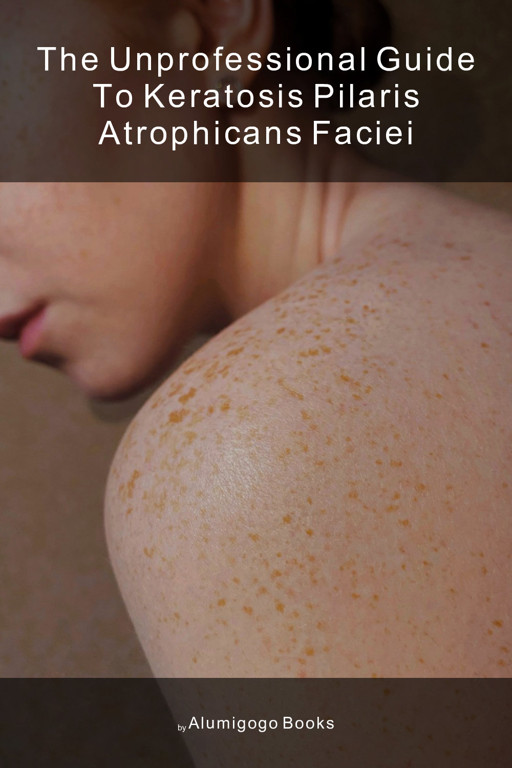 Cover of The Unprofessional Guide to keratosis pilaris atrophicans faciei