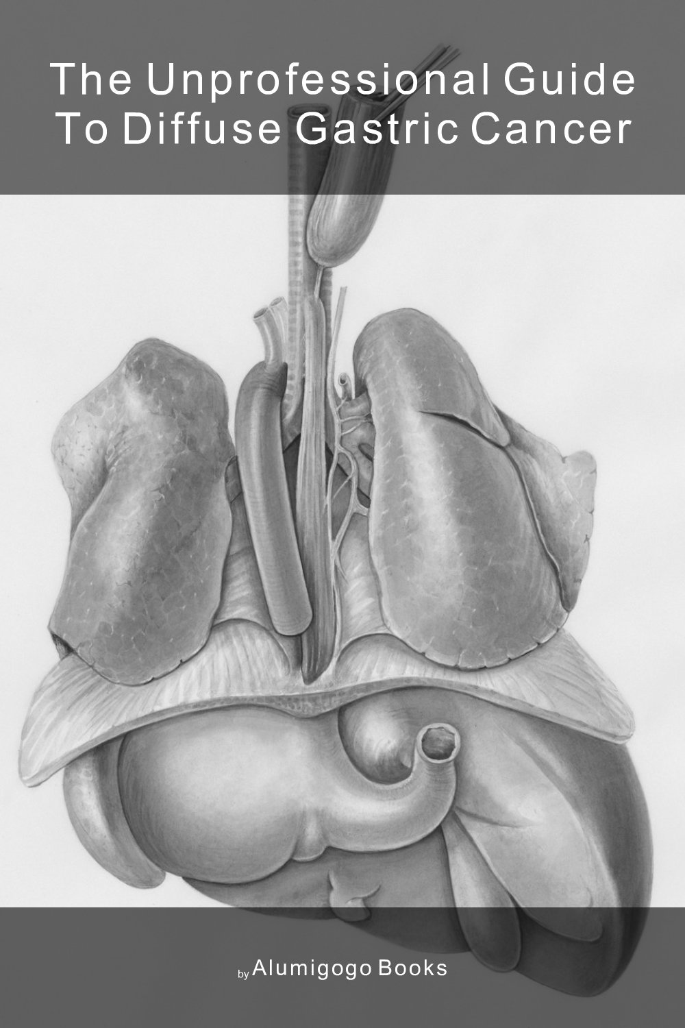 Cover of The Unprofessional Guide to diffuse gastric cancer