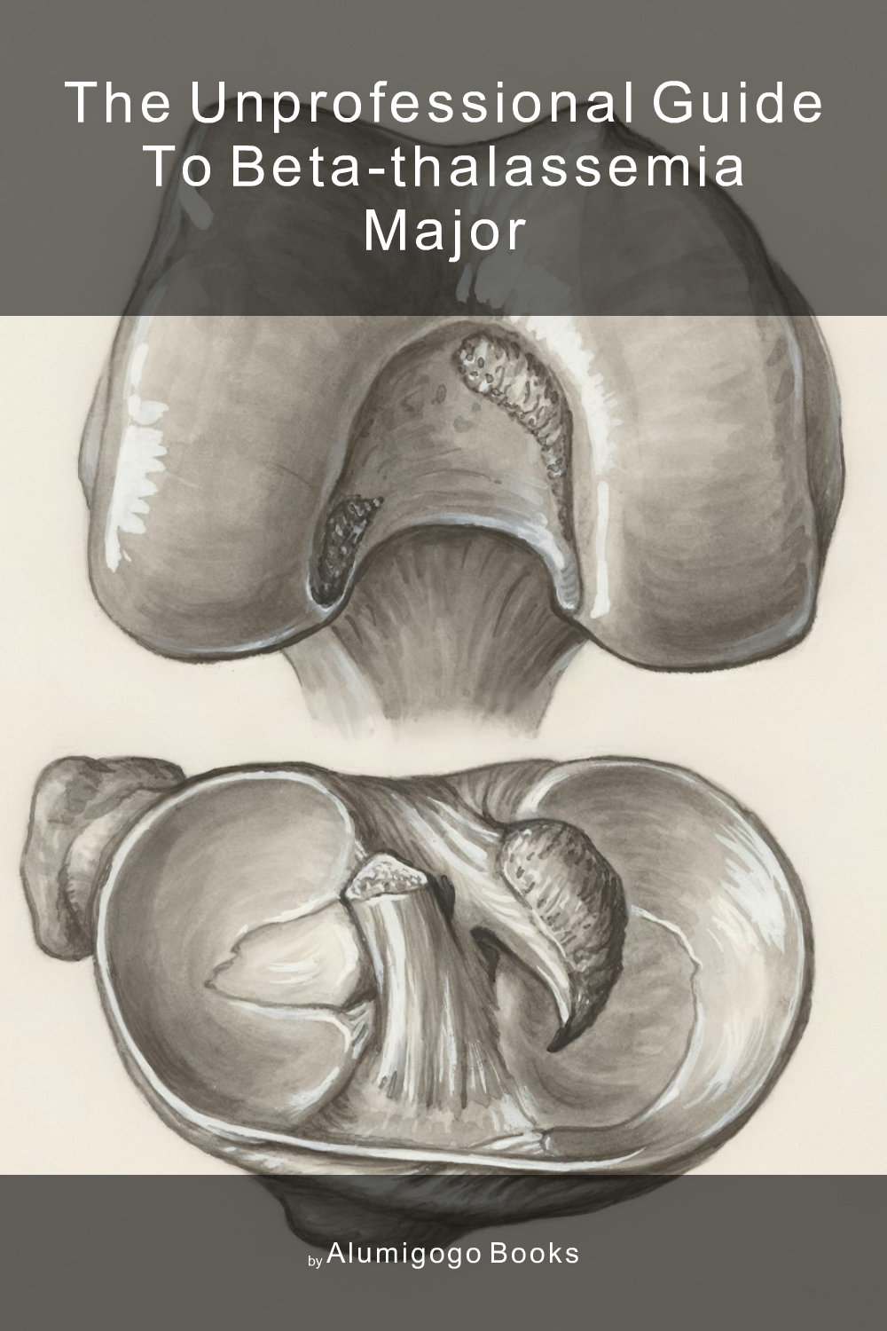 Cover of The Unprofessional Guide to beta-thalassemia major