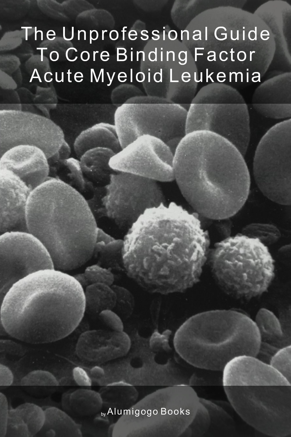 Cover of The Unprofessional Guide to core binding factor acute myeloid leukemia