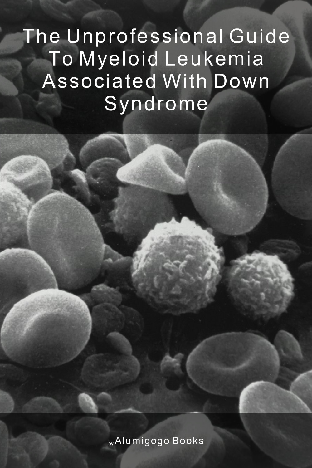 Cover of The Unprofessional Guide to myeloid leukemia associated with Down Syndrome