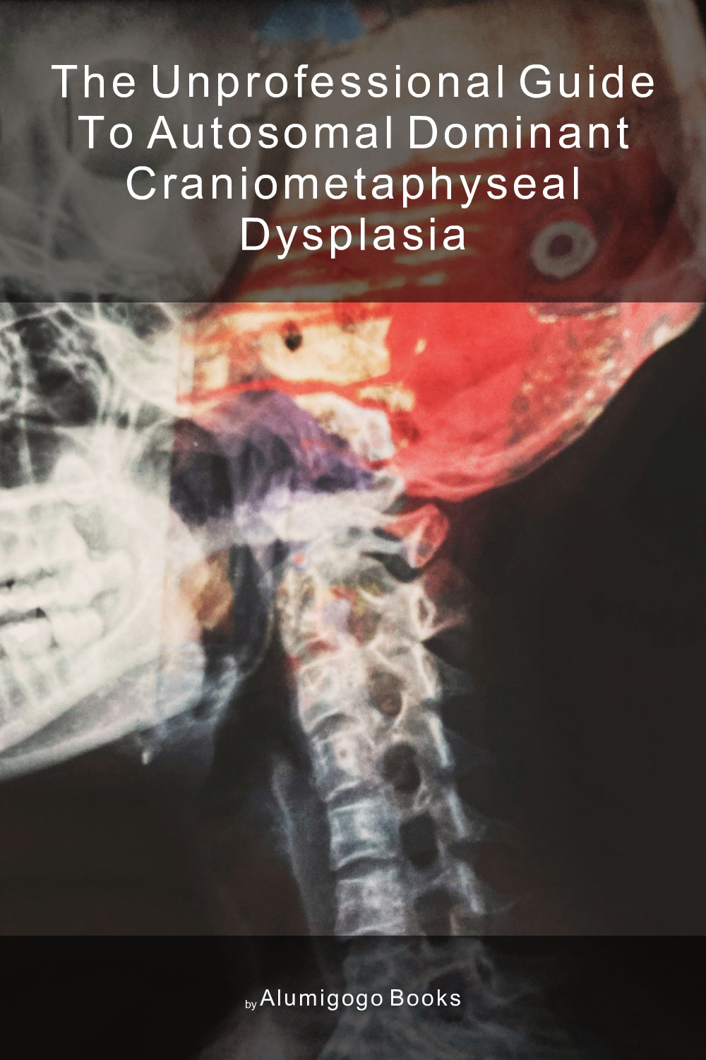 Cover of The Unprofessional Guide to autosomal dominant craniometaphyseal dysplasia