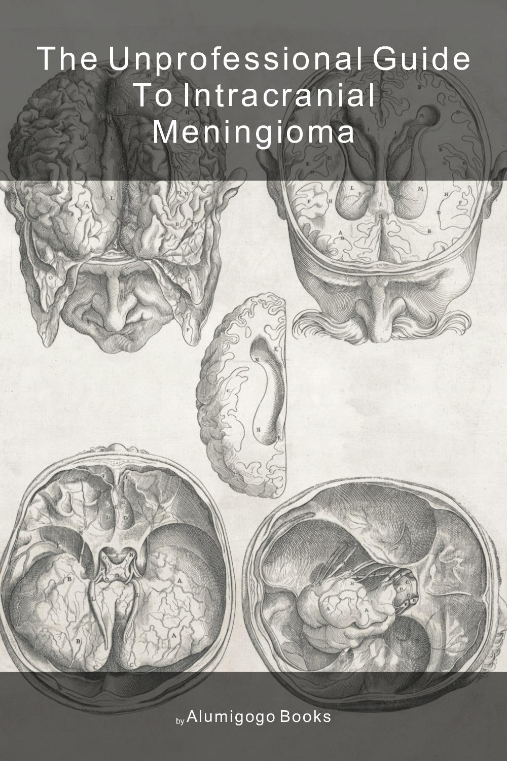 Cover of The Unprofessional Guide to intracranial meningioma