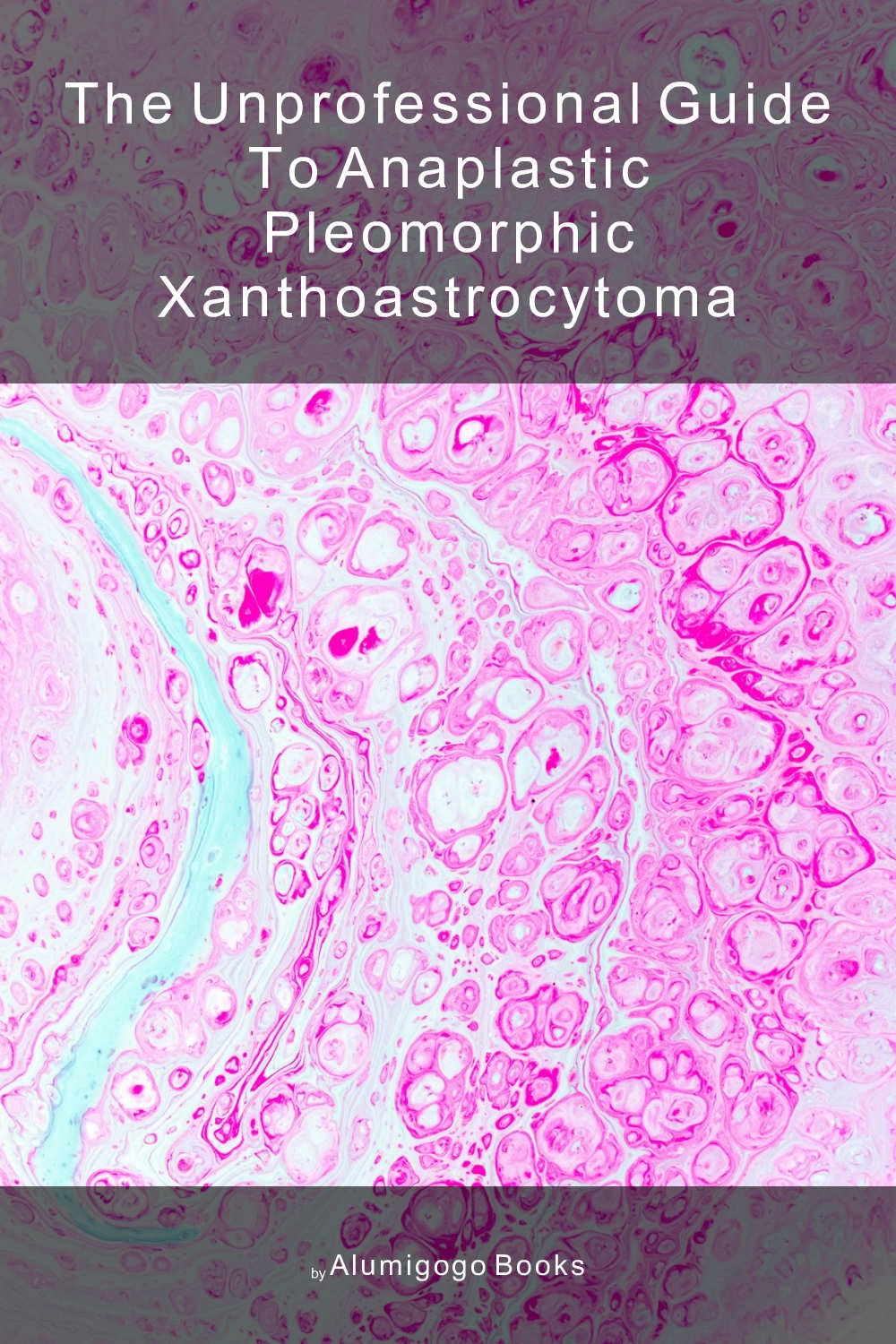 Cover of The Unprofessional Guide to anaplastic pleomorphic xanthoastrocytoma