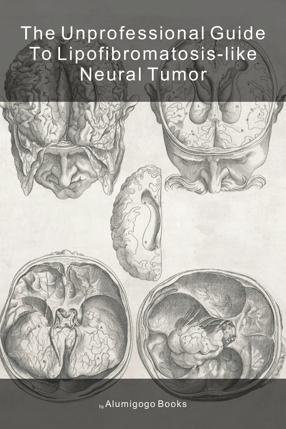 Cover of The Unprofessional Guide to lipofibromatosis-like neural tumor