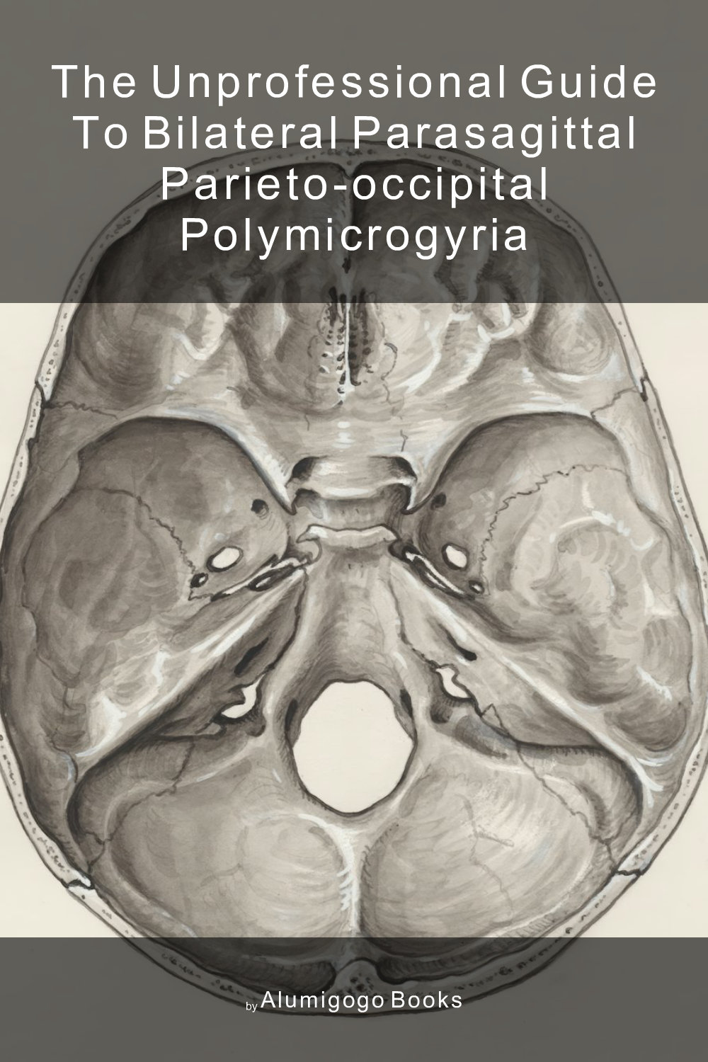 Cover of The Unprofessional Guide to bilateral parasagittal parieto-occipital polymicrogyria