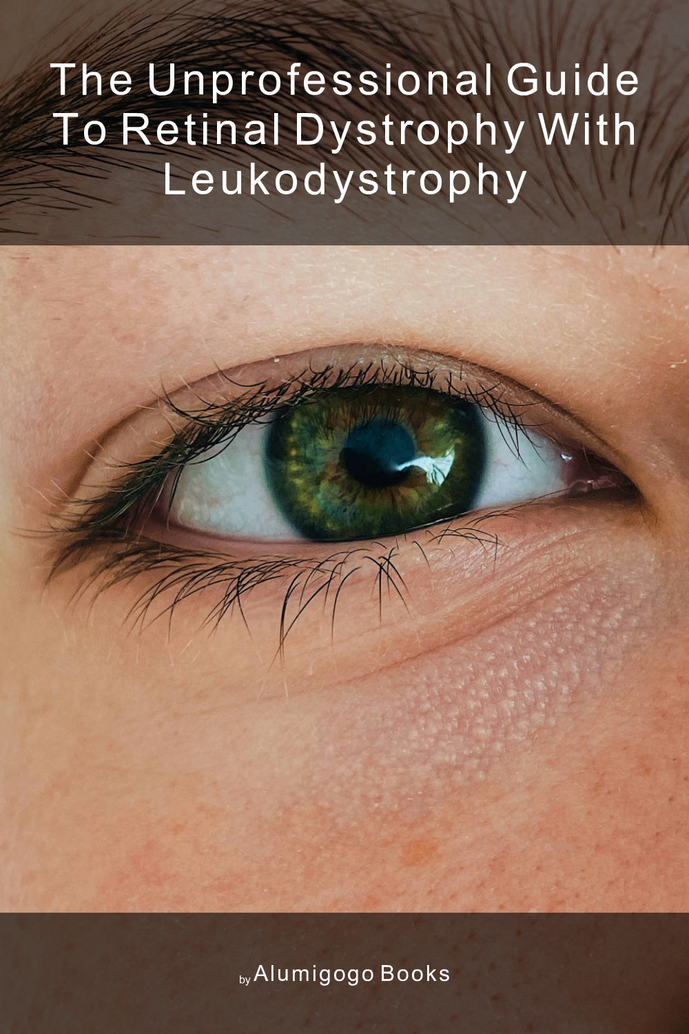 Cover of The Unprofessional Guide to retinal dystrophy with leukodystrophy