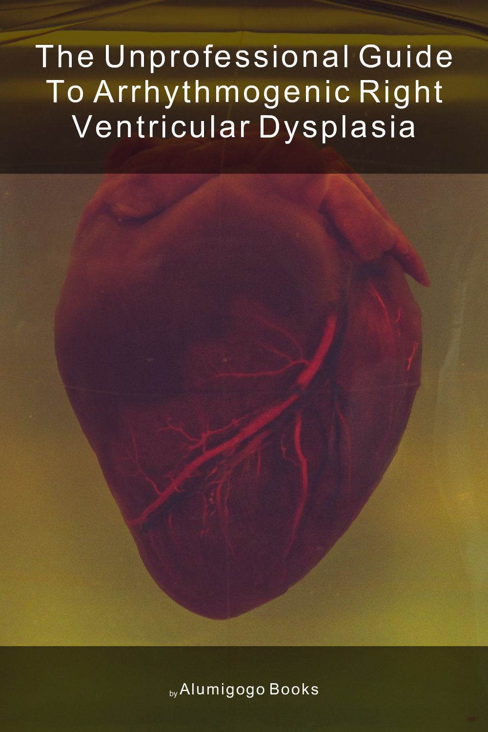 Cover of The Unprofessional Guide to arrhythmogenic right ventricular dysplasia