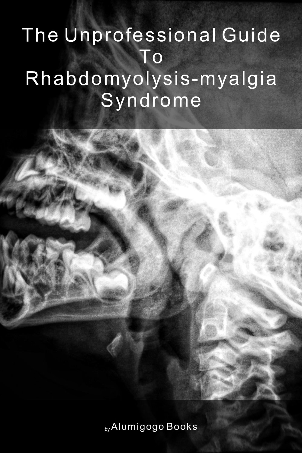 Cover of The Unprofessional Guide to rhabdomyolysis-myalgia syndrome