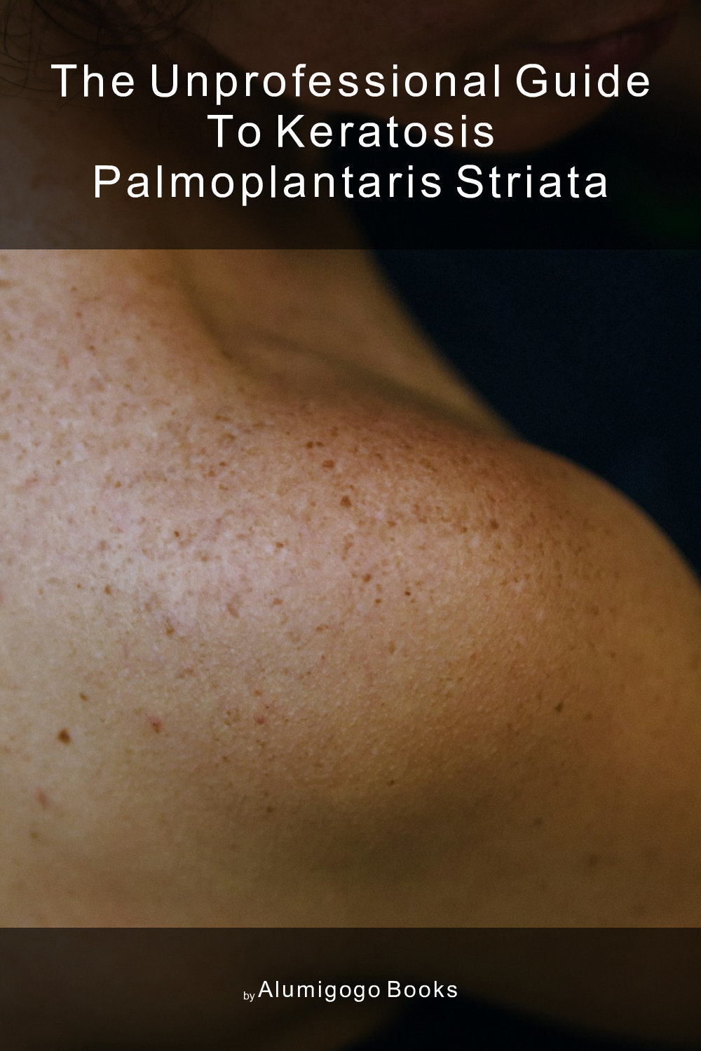 Cover of The Unprofessional Guide to keratosis palmoplantaris striata