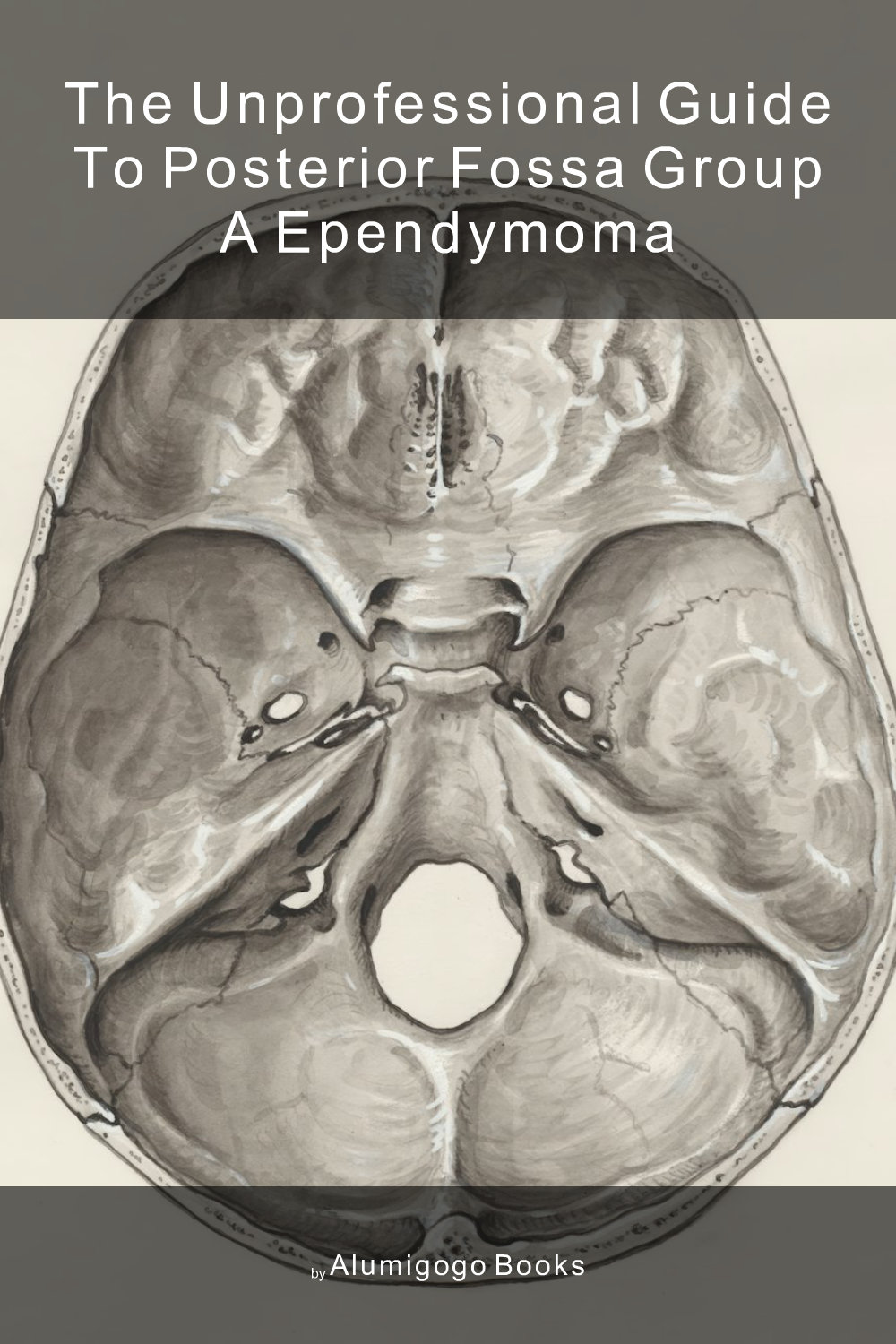 Cover of The Unprofessional Guide to posterior fossa group A ependymoma