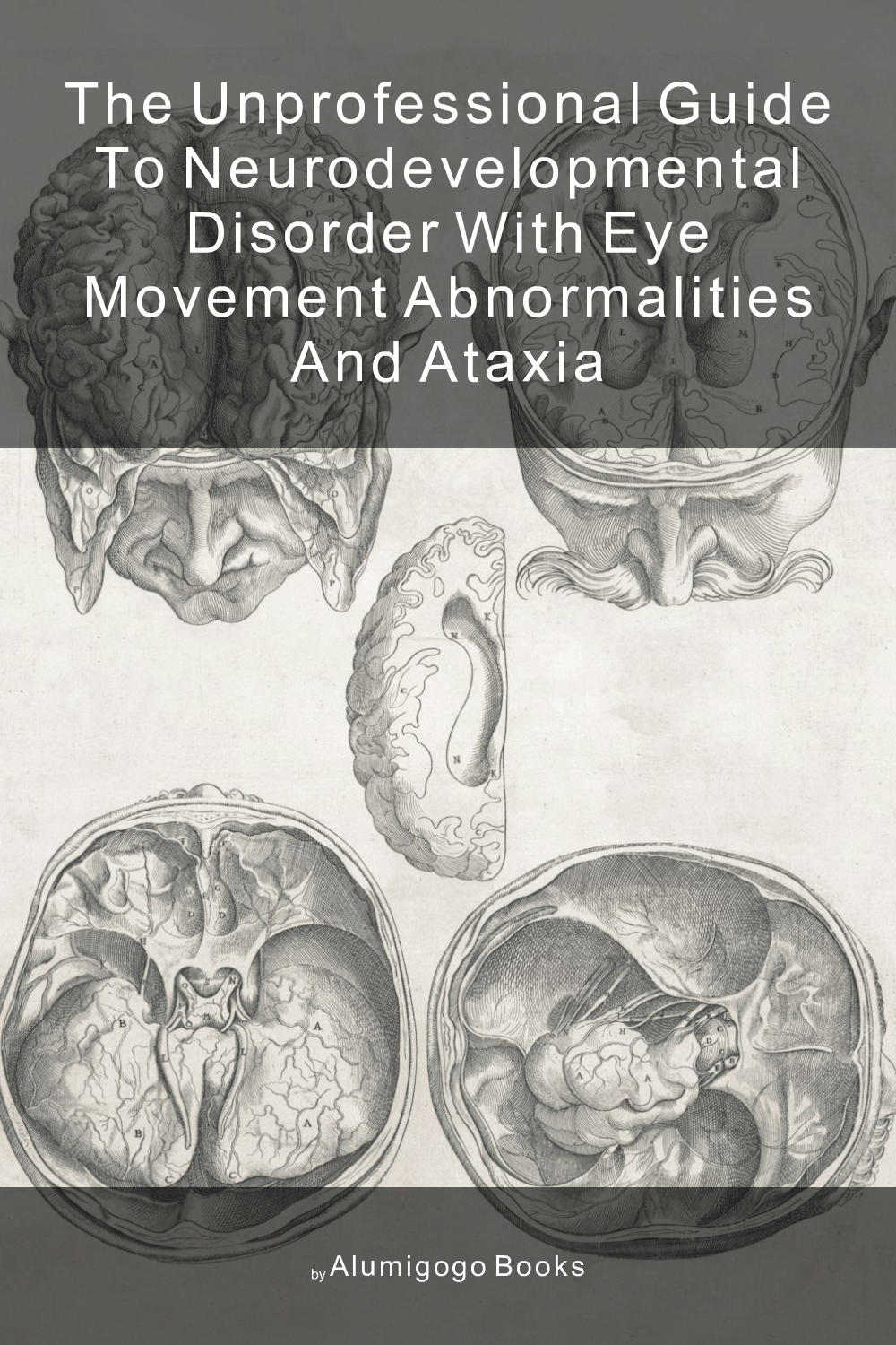 Cover of The Unprofessional Guide to neurodevelopmental disorder with eye movement abnormalities and ataxia
