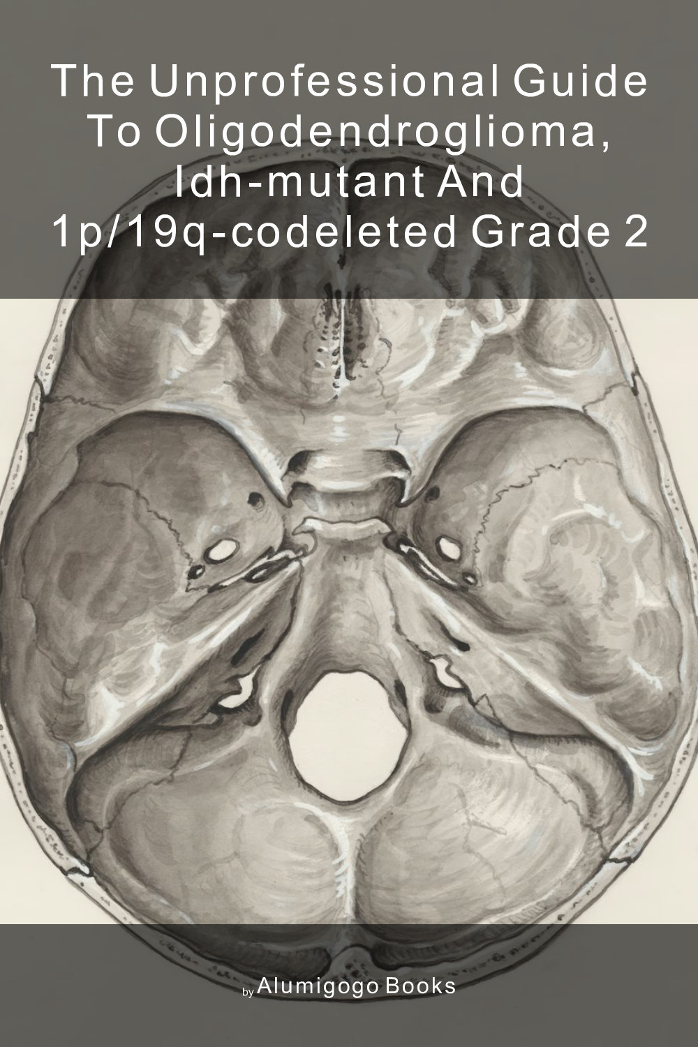 Cover of The Unprofessional Guide to oligodendroglioma, IDH-mutant and 1p/19q-codeleted grade 2