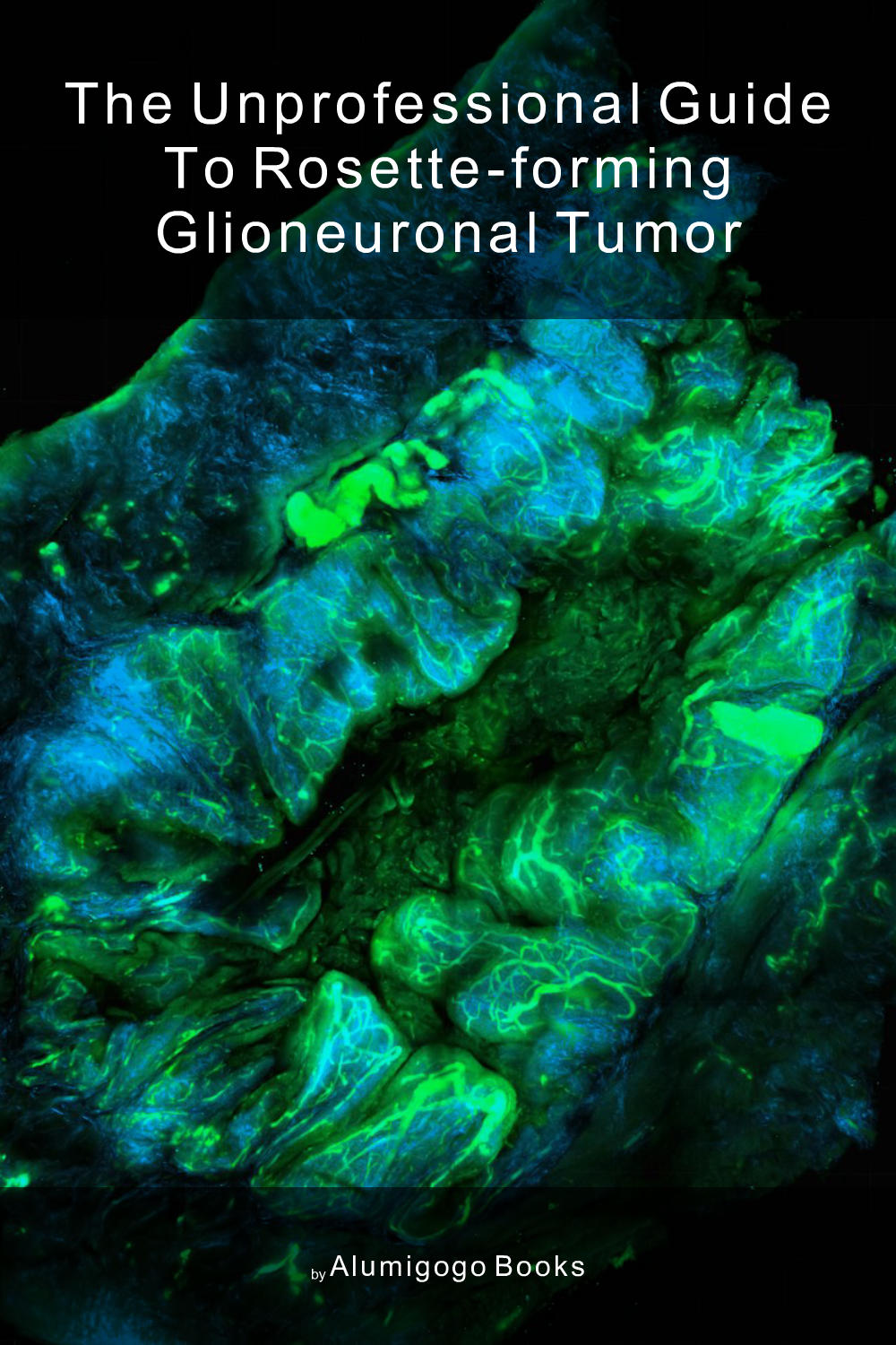 Cover of The Unprofessional Guide to rosette-forming glioneuronal tumor