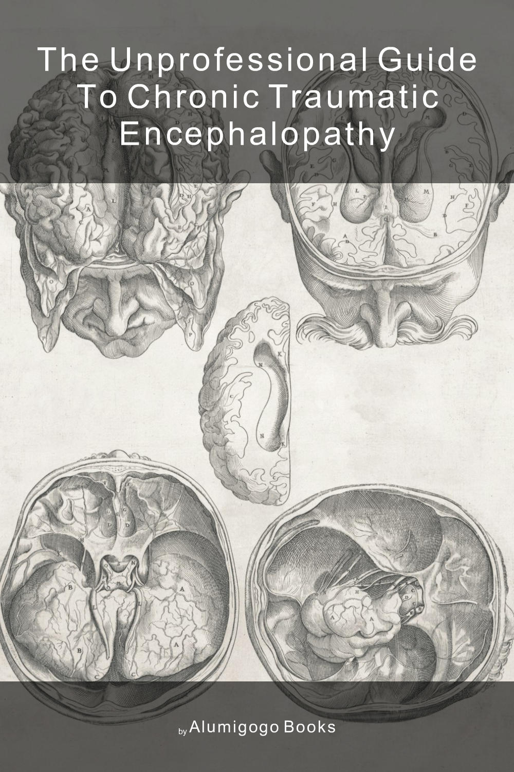 Cover of The Unprofessional Guide to chronic traumatic encephalopathy