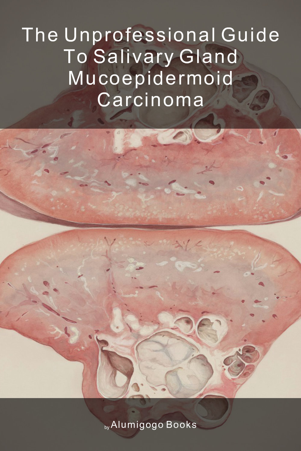 Cover of The Unprofessional Guide to salivary gland mucoepidermoid carcinoma