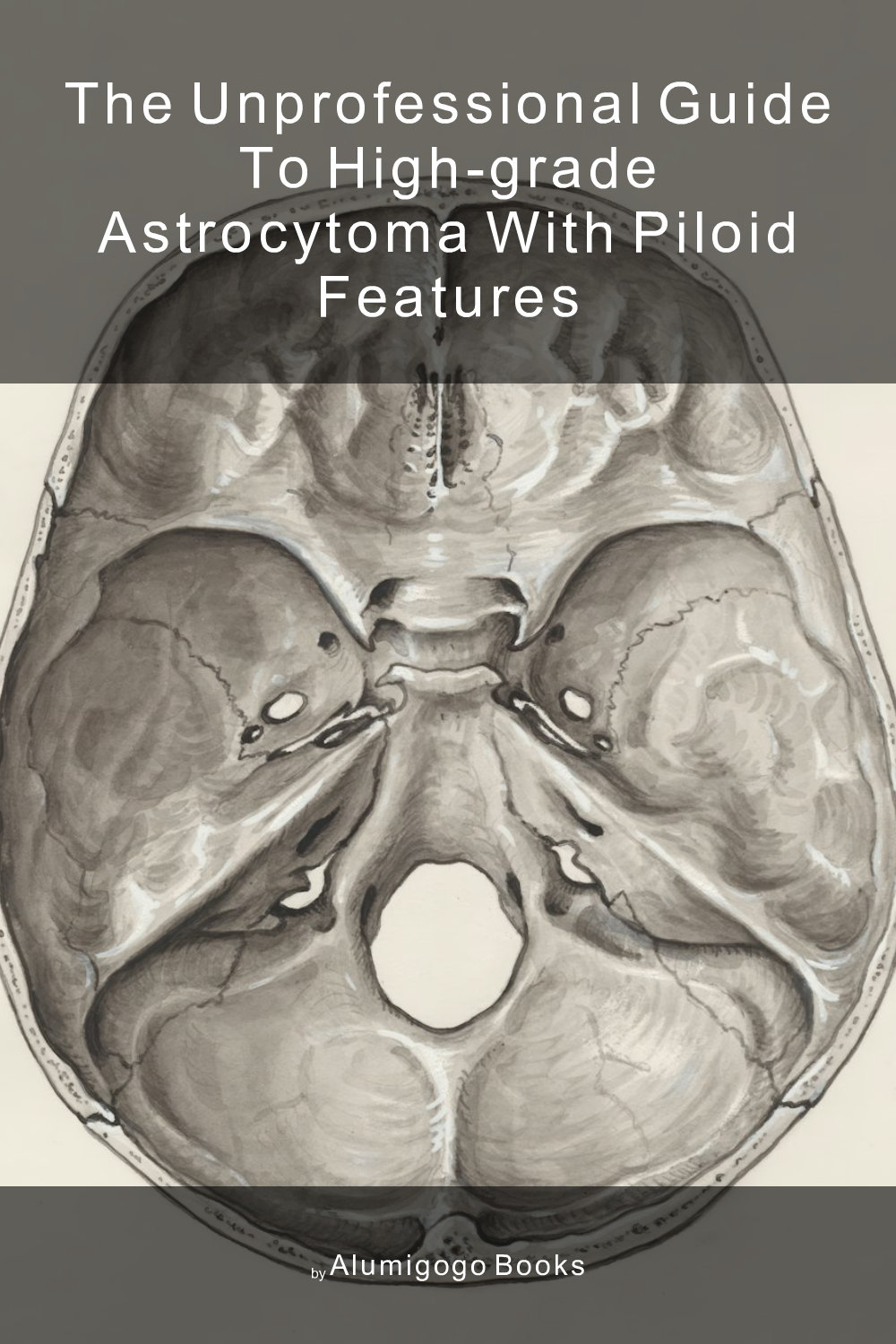 Cover of The Unprofessional Guide to high-grade astrocytoma with piloid features