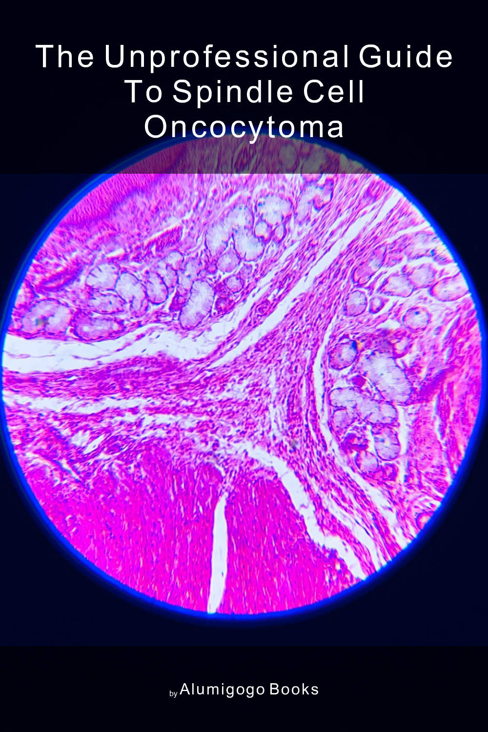 Cover of The Unprofessional Guide to spindle cell oncocytoma