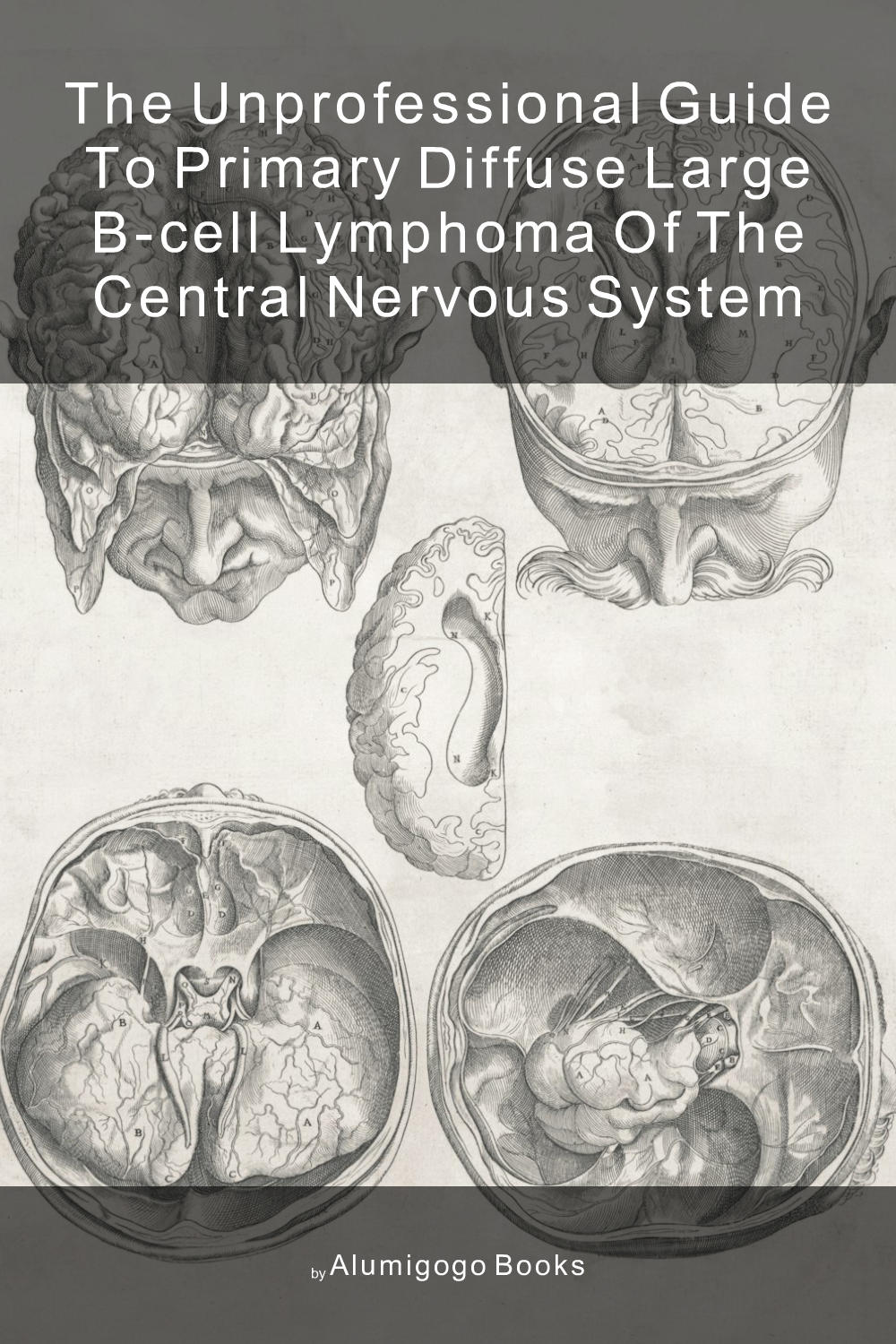 Cover of The Unprofessional Guide to primary diffuse large B-cell lymphoma of the central nervous system
