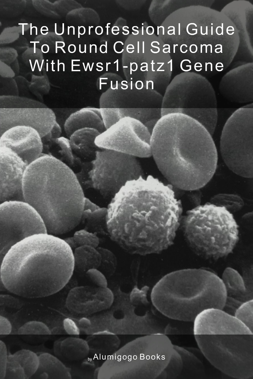 Cover of The Unprofessional Guide to round cell sarcoma with EWSR1-PATZ1 gene fusion