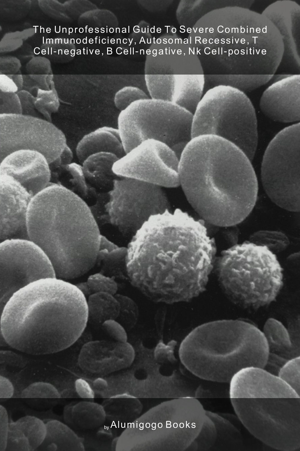 Cover of The Unprofessional Guide to severe combined immunodeficiency, autosomal recessive, T cell-negative, B cell-negative, Nk cell-positive