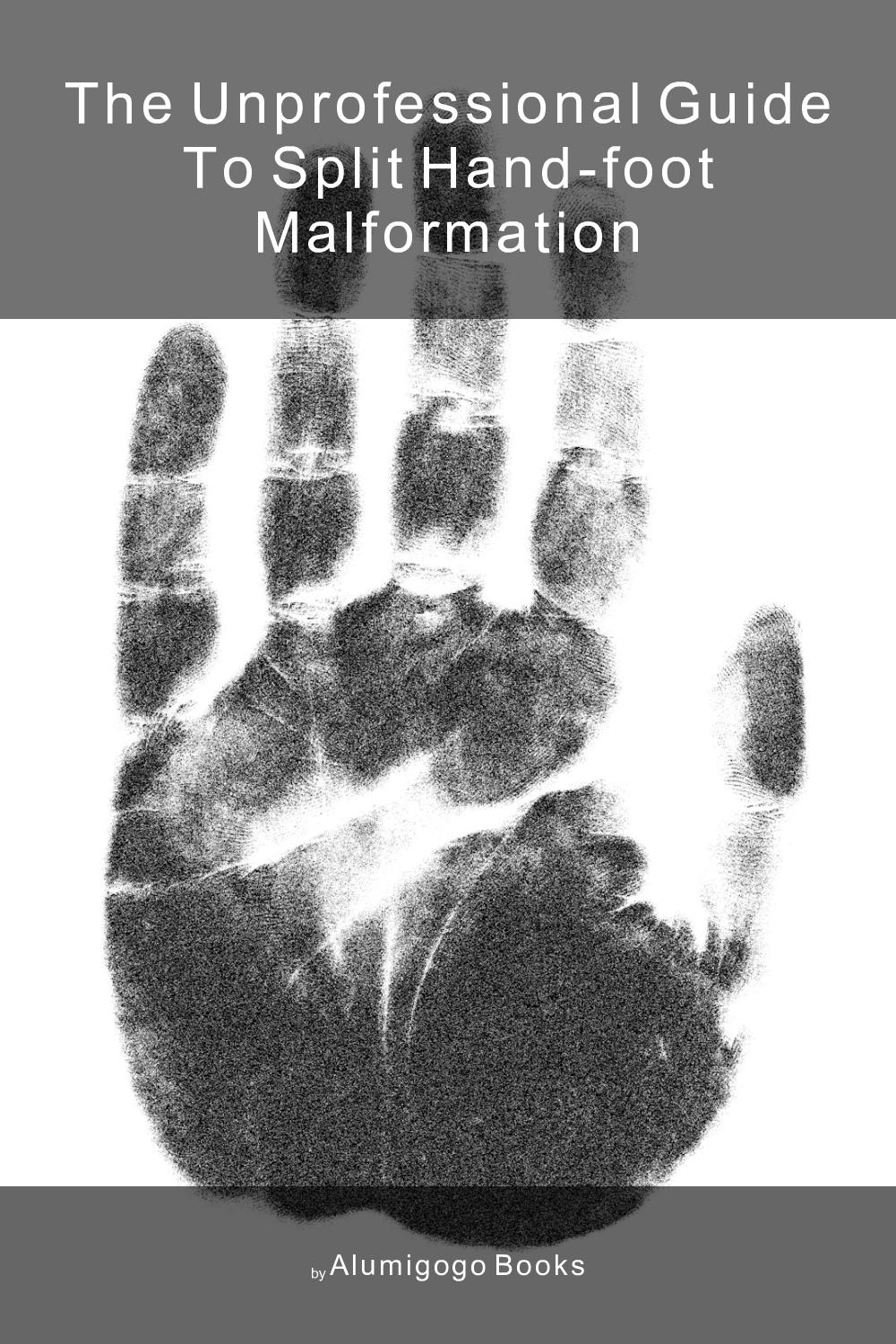 Cover of The Unprofessional Guide to split hand-foot malformation