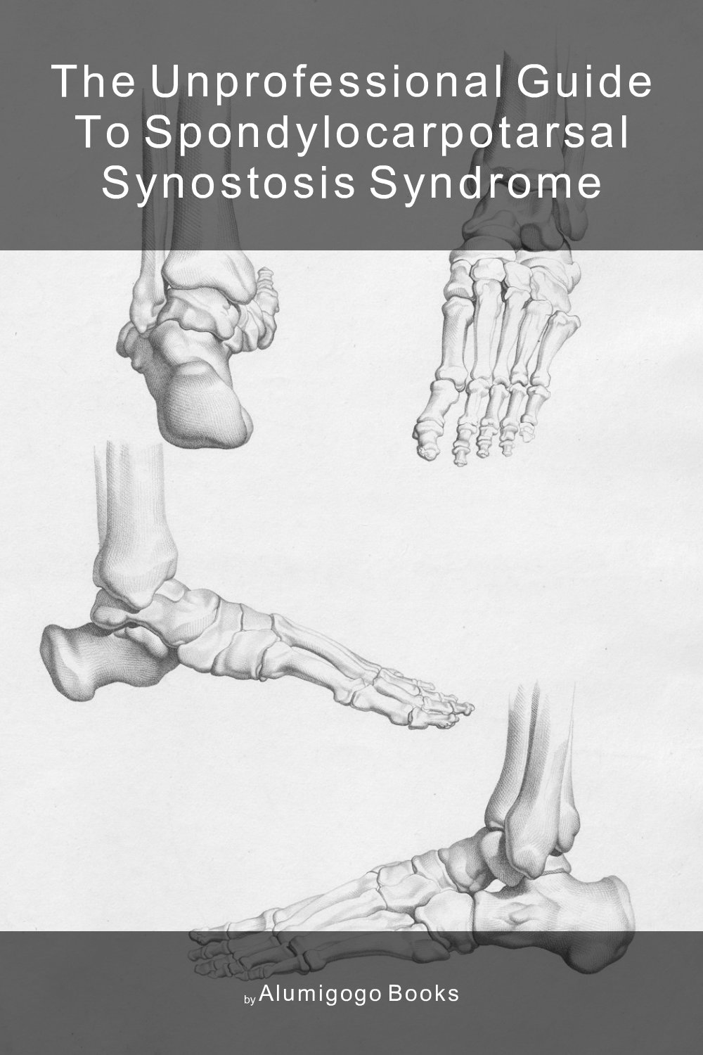 Cover of The Unprofessional Guide to spondylocarpotarsal synostosis syndrome