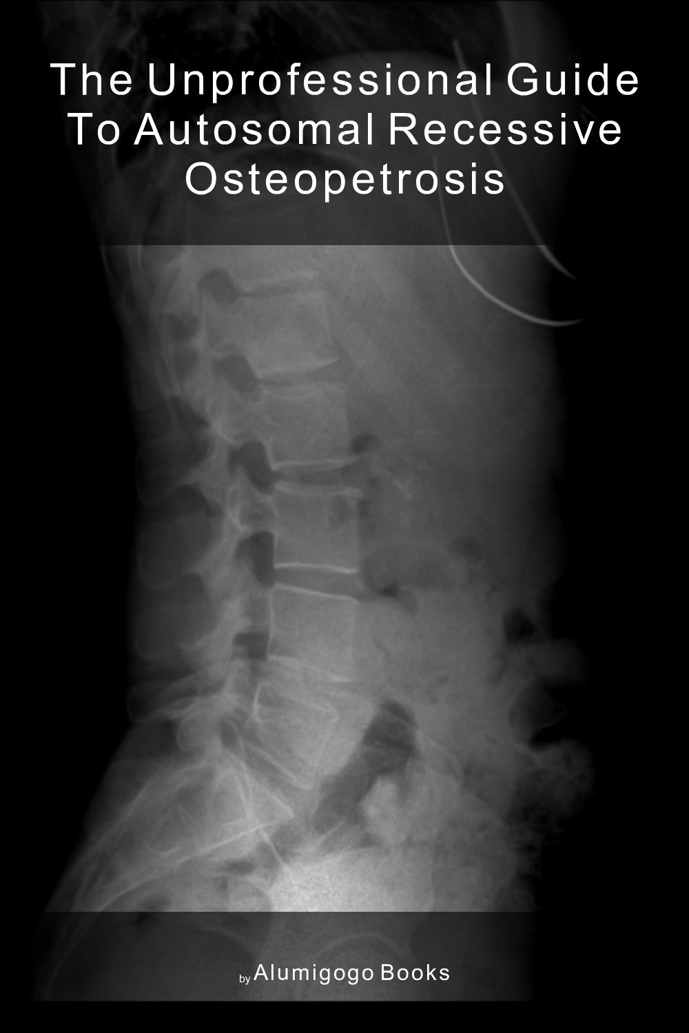 Cover of The Unprofessional Guide to autosomal recessive osteopetrosis