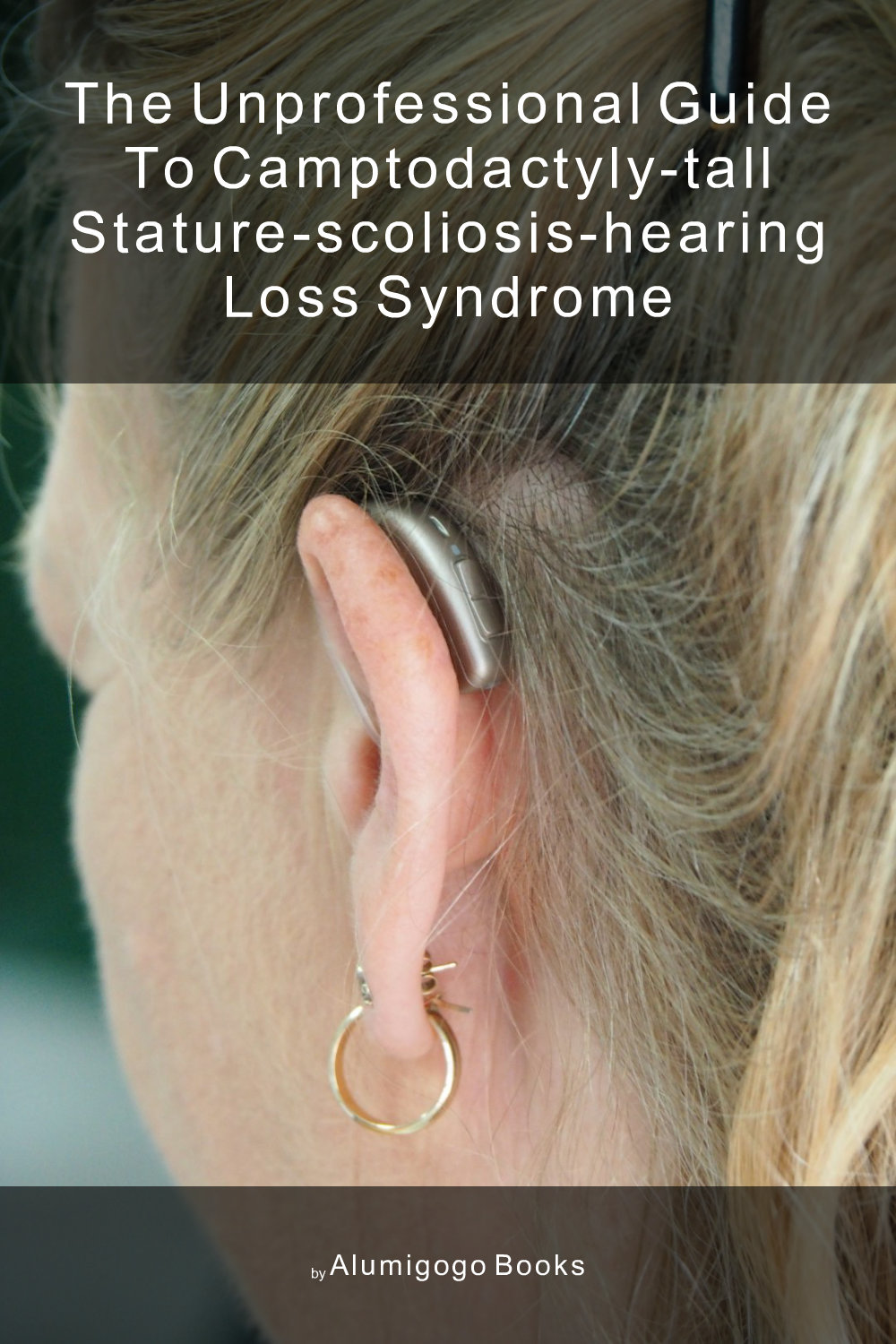 Cover of The Unprofessional Guide to camptodactyly-tall stature-scoliosis-hearing loss syndrome
