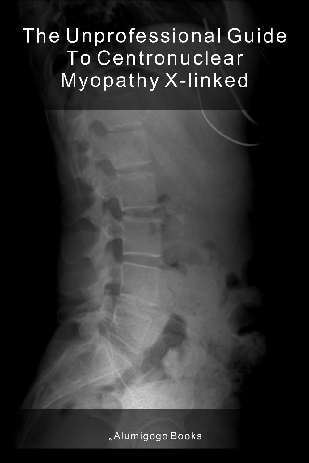 Cover of The Unprofessional Guide to centronuclear myopathy X-linked