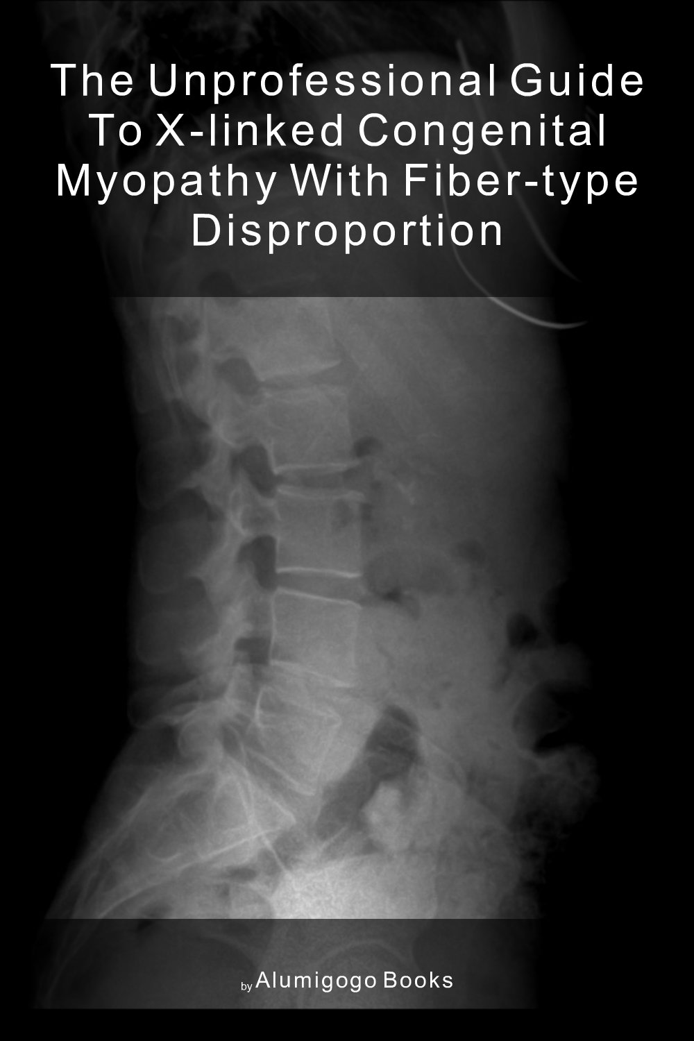 Cover of The Unprofessional Guide to X-linked congenital myopathy with fiber-type disproportion