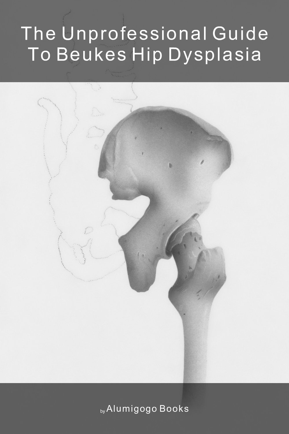 Cover of The Unprofessional Guide to Beukes hip dysplasia