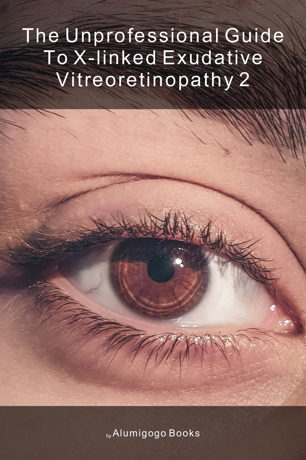 Cover of The Unprofessional Guide to X-linked exudative vitreoretinopathy 2