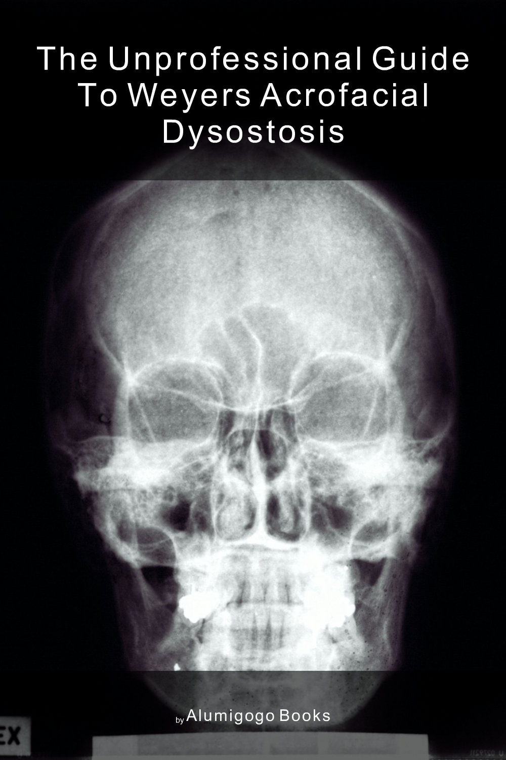 Cover of The Unprofessional Guide to Weyers acrofacial dysostosis