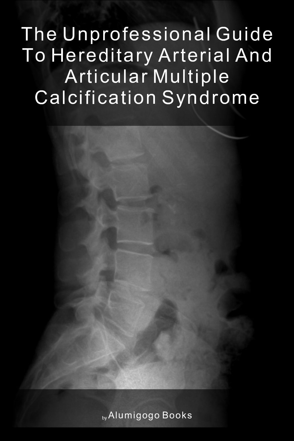 Cover of The Unprofessional Guide to hereditary arterial and articular multiple calcification syndrome