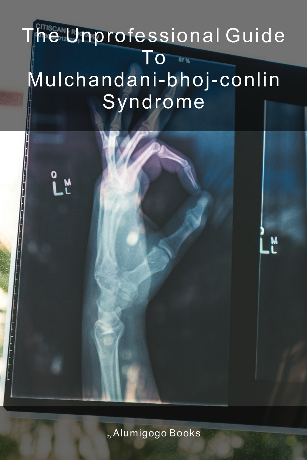 Cover of The Unprofessional Guide to Mulchandani-Bhoj-Conlin syndrome
