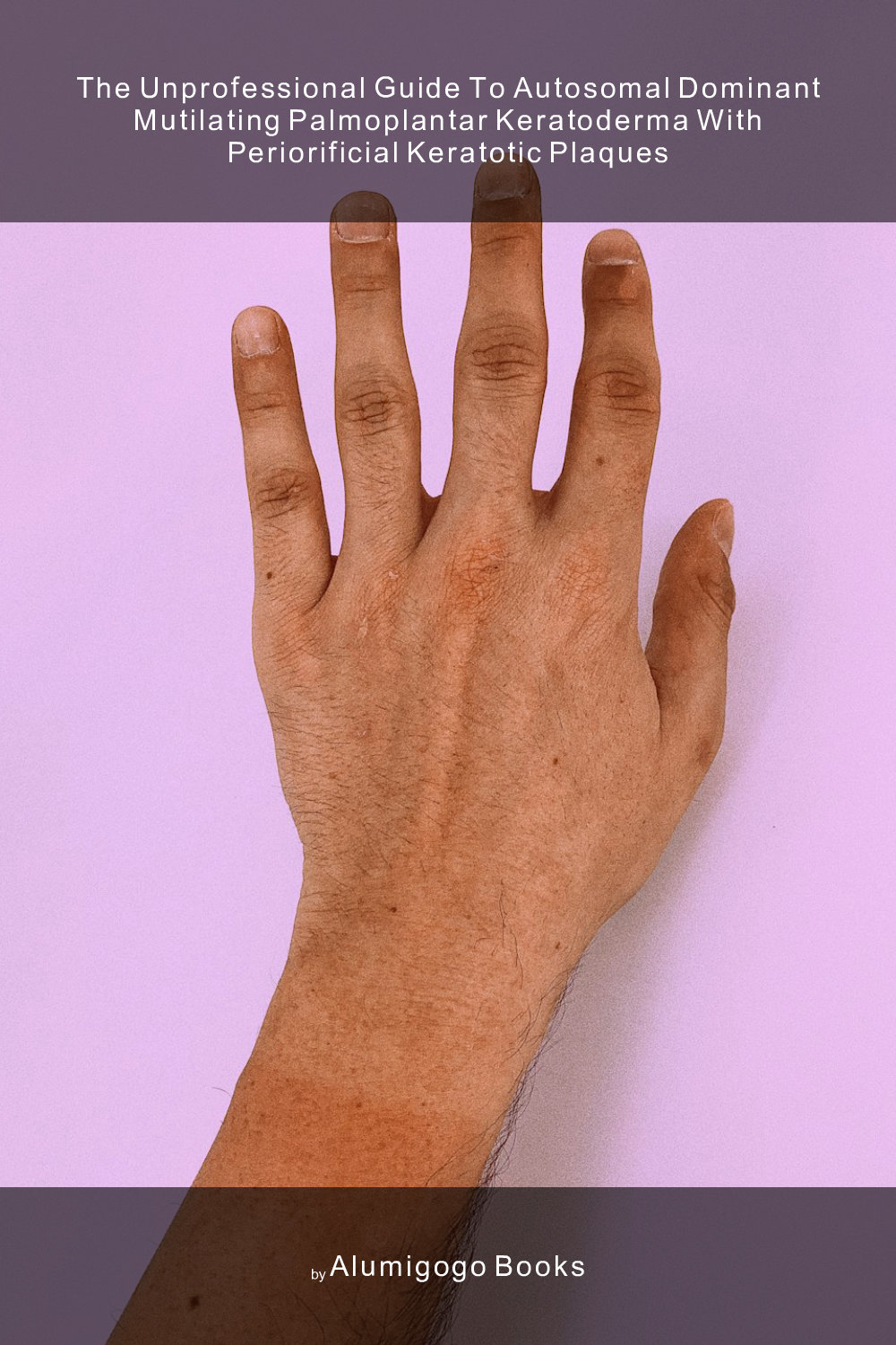 Cover of The Unprofessional Guide to autosomal dominant mutilating palmoplantar keratoderma with periorificial keratotic plaques
