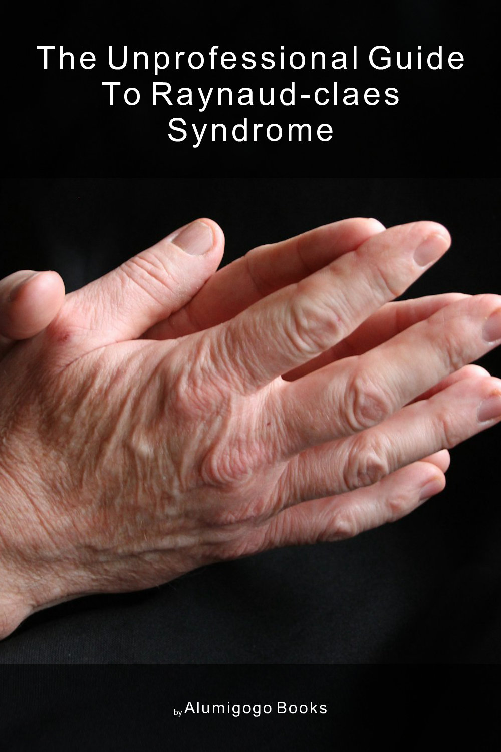 Cover of The Unprofessional Guide to Raynaud-Claes syndrome