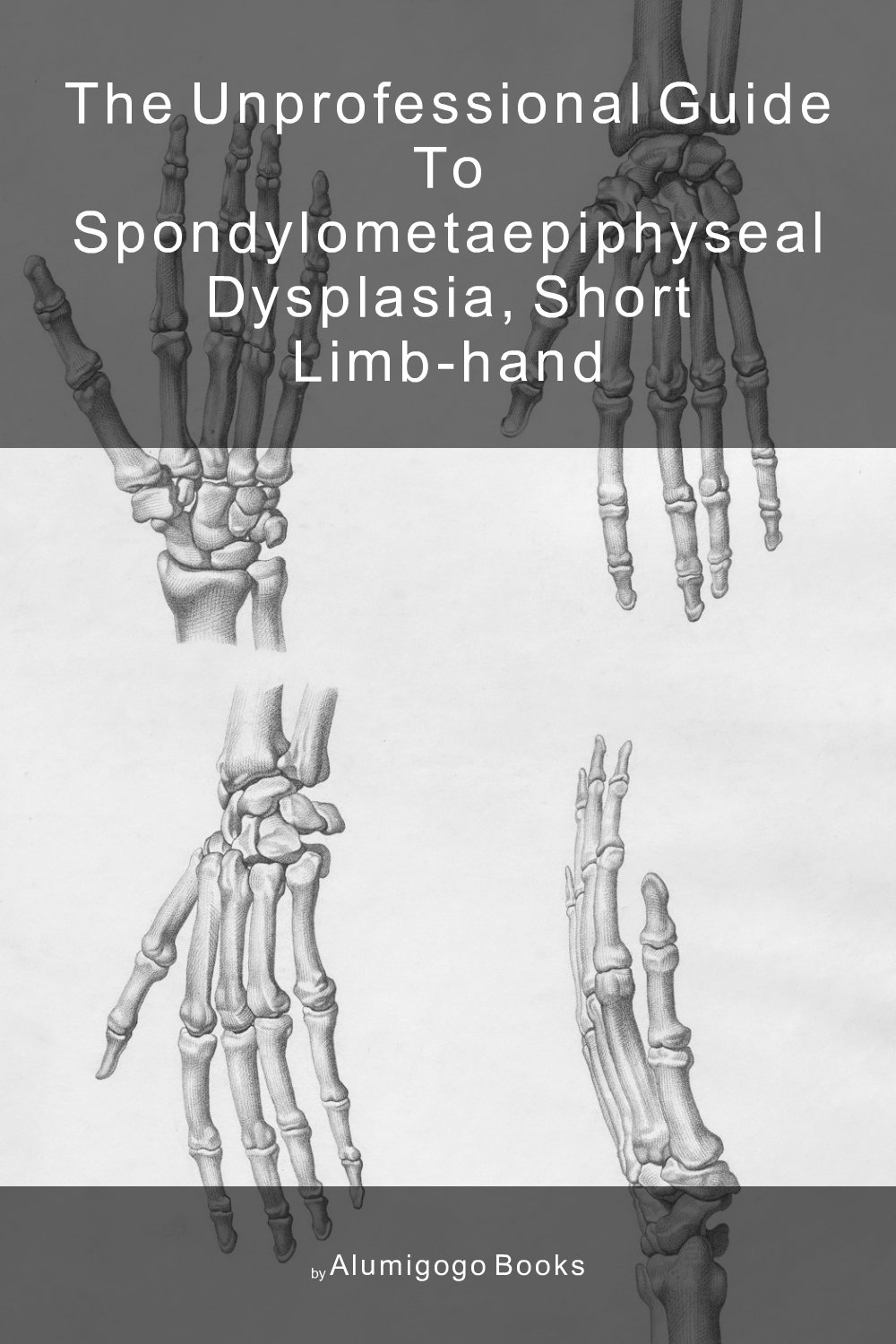 Cover of The Unprofessional Guide to spondylometaepiphyseal dysplasia, short limb-hand
