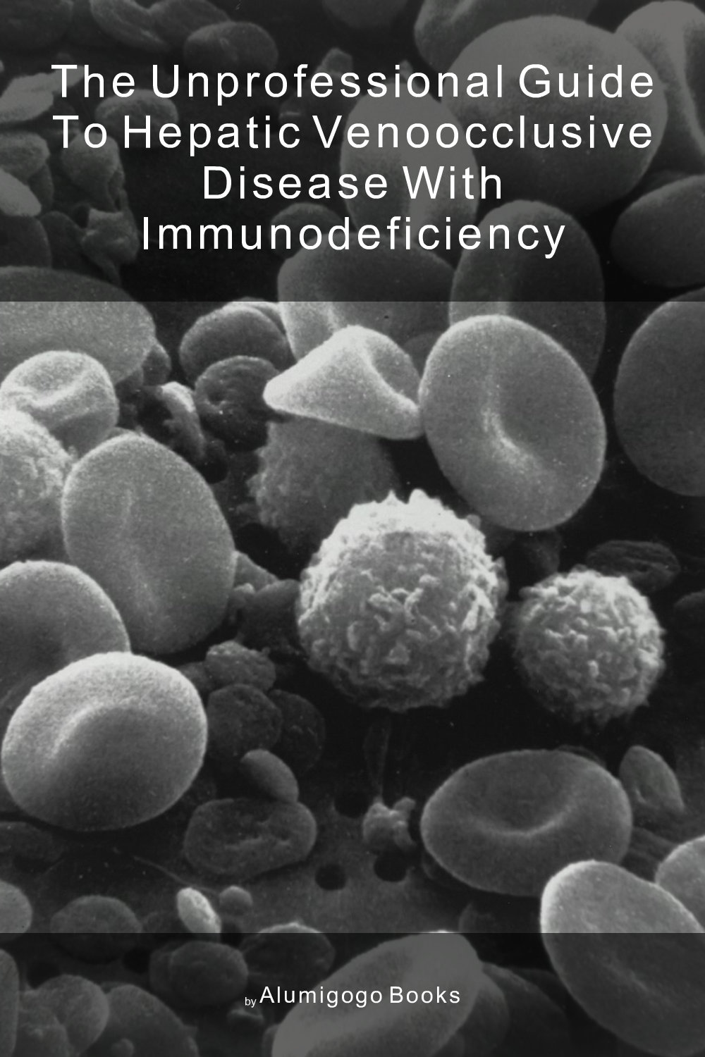 Cover of The Unprofessional Guide to hepatic venoocclusive disease with immunodeficiency