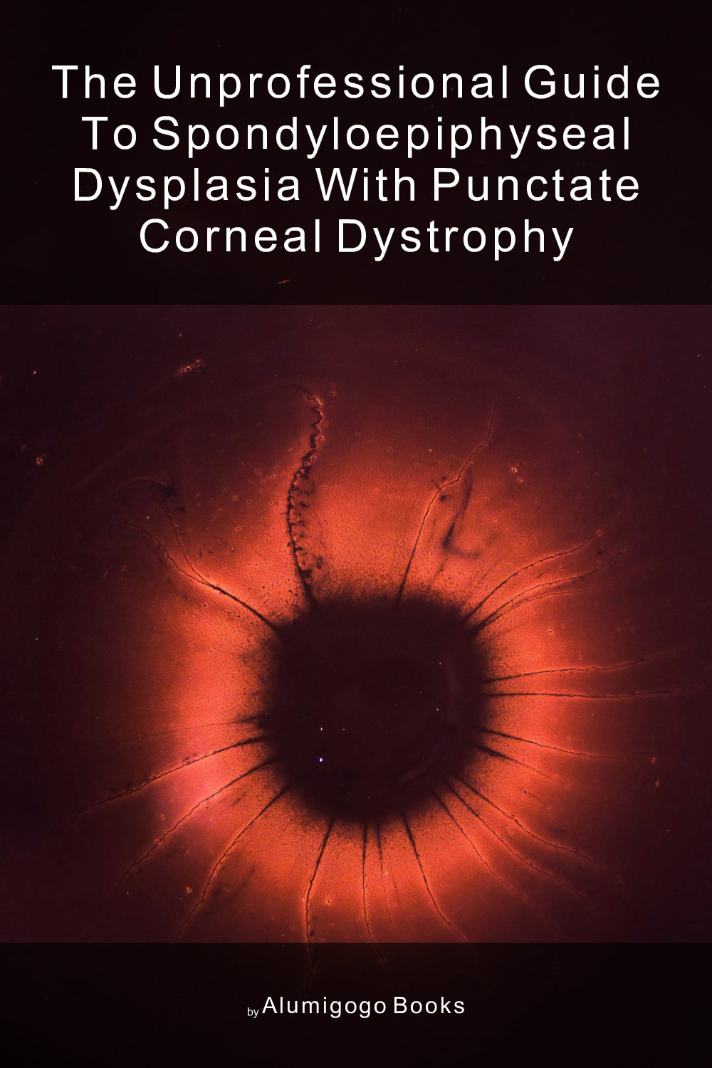 Cover of The Unprofessional Guide to spondyloepiphyseal dysplasia with punctate corneal dystrophy